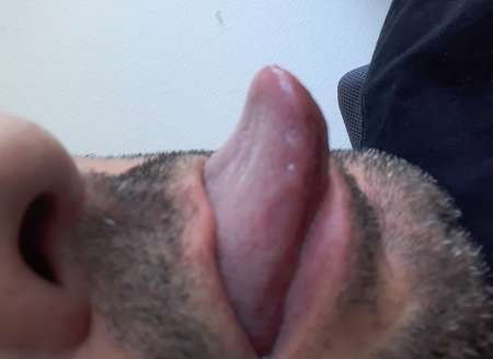 Sp�cial Cuni pour vous mesdames