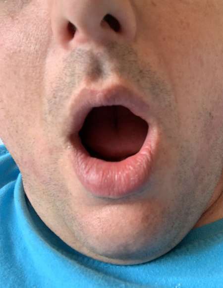 Bouche � gaver fond de gorge